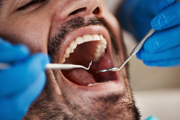 Best After-Hours Emergency Dentist in Edgemere, MD